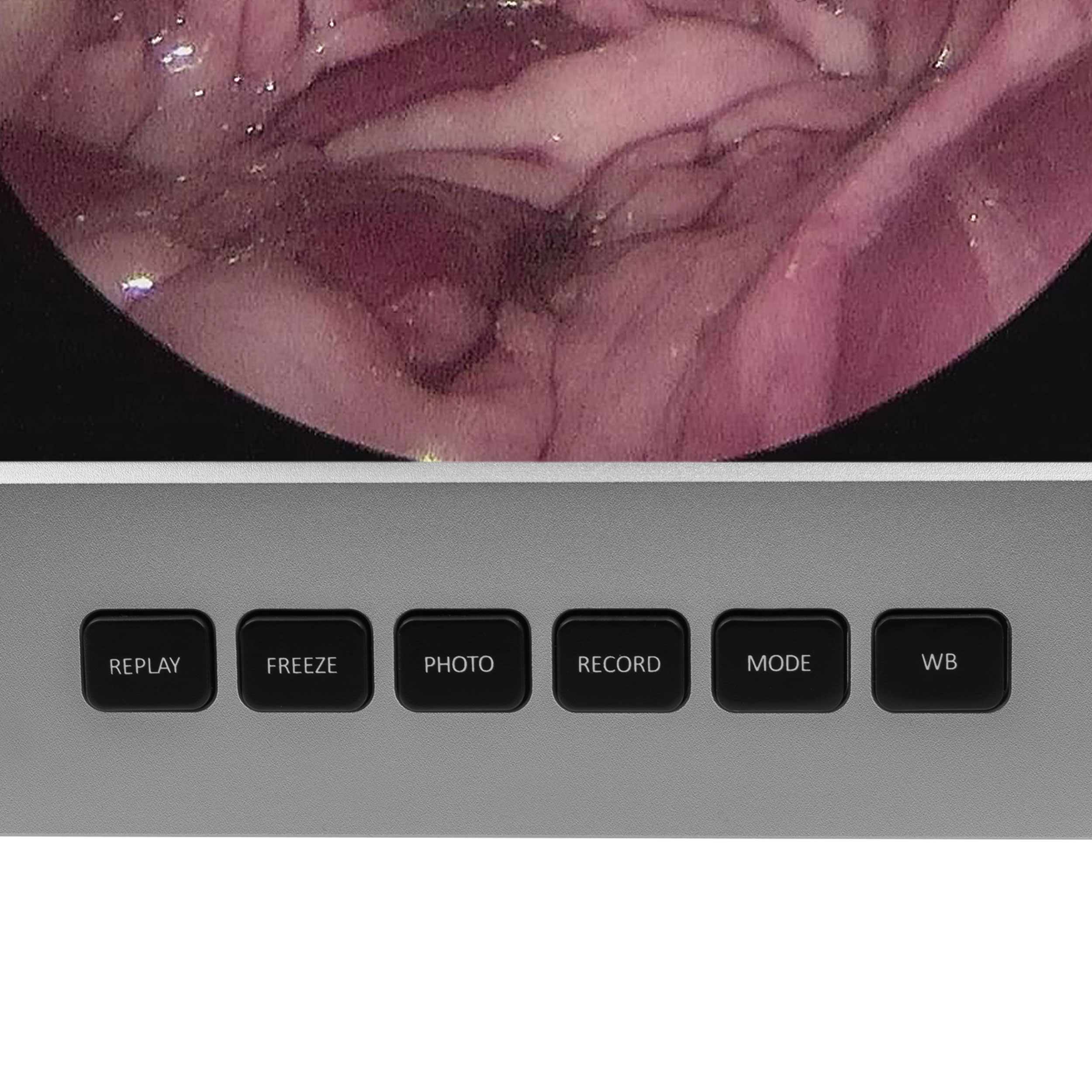 Monitor endoskopi EickView 4-i-1
