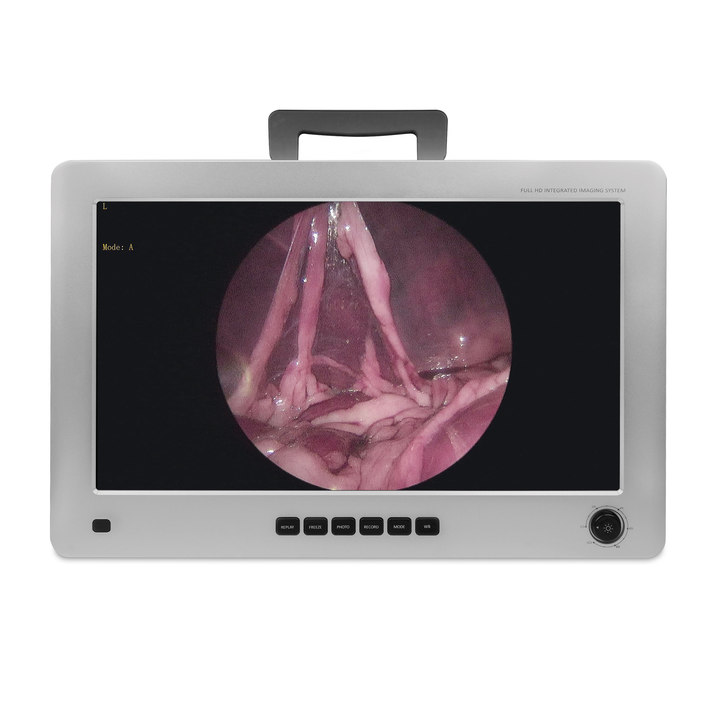 Monitor endoskopi EickView 4-i-1