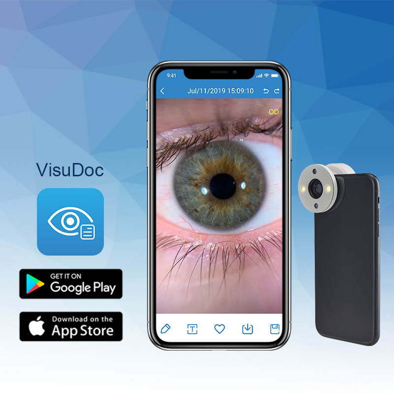 Smartphone Eye Imaging Adaptor